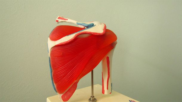 chronische pijn, schouder model